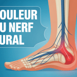 Illustration trajet douleur nerf sural jambe
