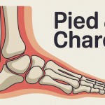 Illustration pied de charcot coupe osseuse inflammation
