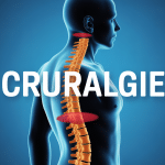 Cruralgie mouvements à éviter illustration nerf crural zones sensibles