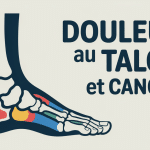 coupe anatomie talon douleur au talon cancer