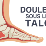 Image douleur sous le talon vue anatomique