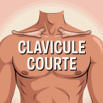 Illustration de clavicule courte sur torse humain