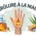 Illustration vectorielle d une brûlure à la main avec eau froide et plantes médicinales