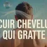 Illustration vectorielle cuir chevelu qui gratte avec picotements et particules