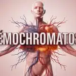 Corps humain stylisé avec organes clés et accumulation de fer hémochromatose