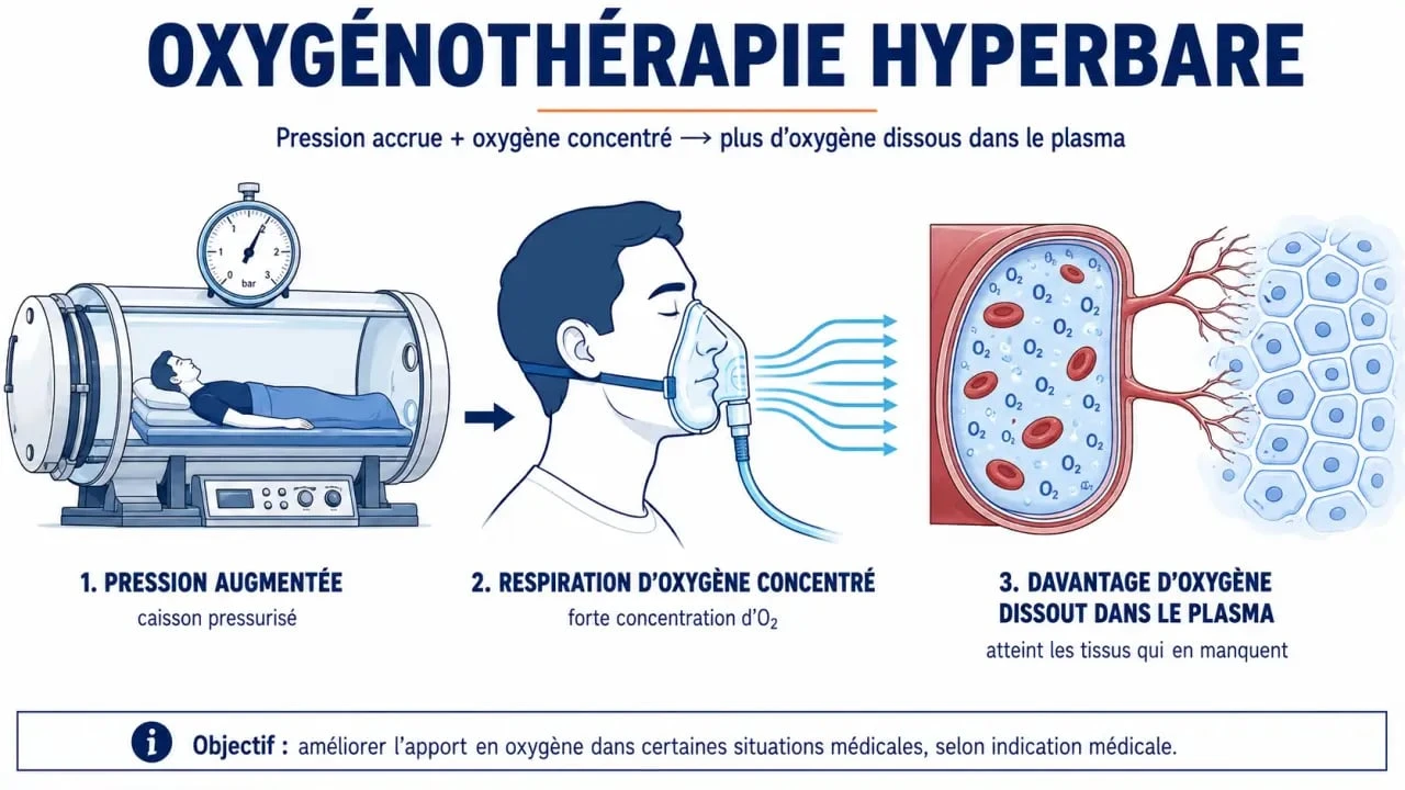 Schéma explicatif du mécanisme de l’oxygénothérapie hyperbare dans un caisson pressurisé
